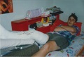 Broken leg in 1994 in early primary school