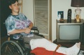 Broken leg in 1994